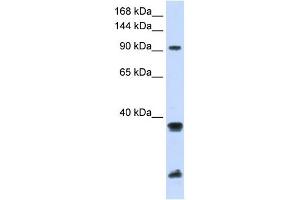 RNF20 antibody used at 1 ug/ml to detect target protein. (RNF20 antibody  (Middle Region))