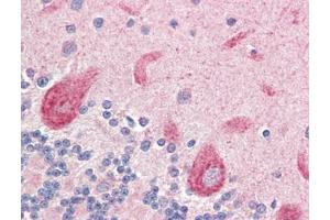 Human Brain, Cerebellum (formalin-fixed, paraffin-embedded) stained with LGI4at 5 µg/ml followed by biotinylated goat anti-rabbit IgG secondary antibody, alkaline phosphatase-streptavidin and chromogen. (LGI4 antibody)