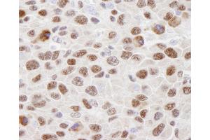 anti-Heterogeneous Nuclear Ribonucleoprotein U (Scaffold Attachment Factor A) (HNRNPU) (AA 450-500) antibody