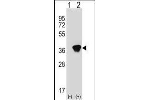 Western blot analysis of AKR1A1 (arrow) using rabbit polyclonal AKR1A1 Antibody (C-term) (ABIN389204 and ABIN2837921). (AKR1A1 antibody  (C-Term))