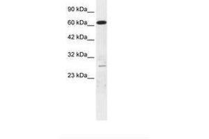 Image no. 2 for anti-Mediator Complex Subunit 17 (MED17) (AA 156-205) antibody (ABIN6735876) (MED17 antibody  (AA 156-205))