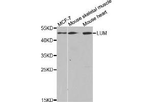 Western Blotting (WB) image for anti-Lumican (LUM) antibody (ABIN1876540) (LUM antibody)