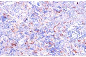 Immunohistochemistry of paraffin-embedded Mouse spleen using CD18 Polyclonal Antibody at dilution of 1:100 (40x lens). (Integrin beta 2 antibody)