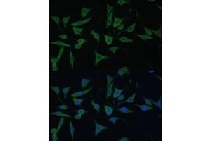 Immunofluorescence analysis of L929 cells using HIBCH antibody (ABIN7265331) at dilution of 1:100. (HIBCH antibody  (AA 33-330))