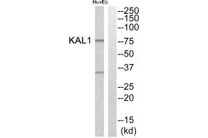 Western Blotting (WB) image for anti-Kallmann Syndrome 1 Sequence (KAL1) (Internal Region) antibody (ABIN1850776) (KAL1 antibody  (Internal Region))