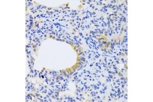 Immunohistochemistry (Paraffin-embedded Sections) (IHC (p)) image for anti-Mitochondrial Ribosomal Protein S30 (MRPS30) (AA 190-439) antibody (ABIN6144043)