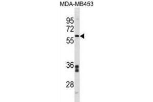 Western Blotting (WB) image for anti-Flavin Containing Monooxygenase 5 (FMO5) antibody (ABIN3001414) (FMO5 antibody)