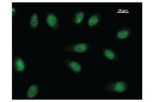 Immunostaining analysis in HeLa cells. (TEAD2 antibody)