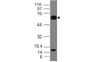 Image no. 1 for anti-Interleukin 1 Receptor-Like 2 (IL1RL2) (AA 1-203) antibody (ABIN5027303) (IL1RL2 antibody  (AA 1-203))