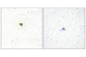 Immunohistochemistry analysis of paraffin-embedded human brain tissue using JKIP2 antibody. (JAKMIP2 antibody  (C-Term))