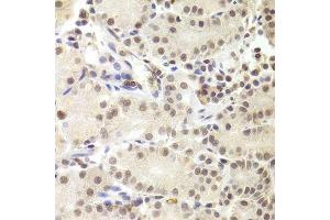 Immunohistochemistry of paraffin-embedded human stomach using PRPF3 Antibody.