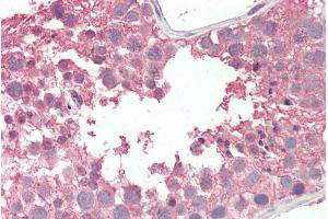 ABIN570703 (5µg/ml) staining of paraffin embedded Human Testis. (RCBTB2 antibody  (Internal Region))
