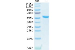 Human APRIL Trimer on Tris-Bis PAGE under reduced condition. (TNFSF13 Protein (Trimer) (His-DYKDDDDK Tag))