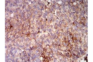 Immunohistochemistry (IHC) image for anti-Major Histocompatibility Complex, Class I, B (HLA-B) (AA 241-362) antibody (ABIN5542338)