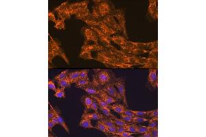 Immunofluorescence analysis of C6 cells using VEGFB Rabbit pAb (ABIN3022999, ABIN3023000, ABIN3023001 and ABIN6219338) at dilution of 1:100 (40x lens). (VEGFB antibody  (AA 100-200))