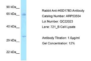 Western Blotting (WB) image for anti-Hydroxysteroid (17-Beta) Dehydrogenase 3 (HSD17B3) (N-Term) antibody (ABIN2785439) (HSD17B3 antibody  (N-Term))