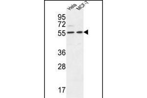DDX6 Antibody (Center) (ABIN653855 and ABIN2843115) western blot analysis in Hela,MCF-7 cell line lysates (35 μg/lane). (DDX6 antibody  (AA 348-375))