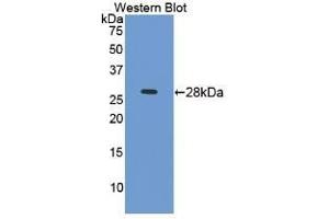 Detection of Recombinant ICAM4, Mouse using Polyclonal Antibody to Intercellular Adhesion Molecule 4 (ICAM4) (ICAM4 antibody  (AA 23-227))