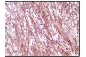 Immunohistochemistry (IHC) image for anti-Desmin (DES) antibody (ABIN1106977) (Desmin antibody)