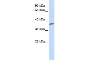 WB Suggested Anti-CCR5 Antibody Titration: 0. (CCR5 antibody  (Middle Region))