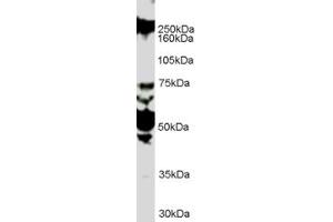 ABIN185537 (1µg/ml) staining of HUVEC lysate (35µg protein in RIPA buffer). (ROBO1 antibody  (Internal Region))