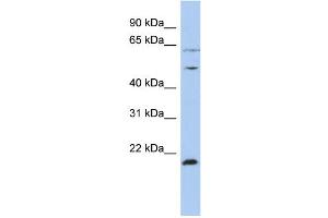 WB Suggested Anti-PSMC2 Antibody Titration:  0.