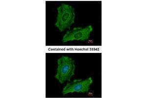 ICC/IF Image Immunofluorescence analysis of methanol-fixed HeLa, using PTPN12, antibody at 1:200 dilution. (PTPN12 antibody  (N-Term))