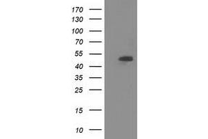 HEK293T cells were transfected with the pCMV6-ENTRY control (Left lane) or pCMV6-ENTRY SNTA1 (Right lane) cDNA for 48 hrs and lysed. (SNTA1 antibody)