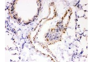 IHC-P: ATP2A2 antibody testing of mouse lung tissue (ATP2A2 antibody  (N-Term))