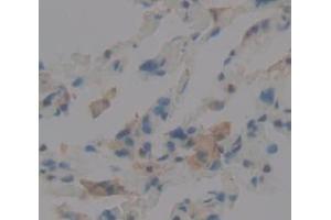 IHC-P analysis of Human Tissue, with DAB staining. (Vitronectin antibody  (AA 400-468))