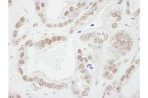 Immunohistochemistry (IHC) image for anti-Budding Uninhibited By Benzimidazoles 3 Homolog (Yeast) (BUB3) (AA 275-325) antibody (ABIN7448449) (BUB3 antibody  (AA 275-325))