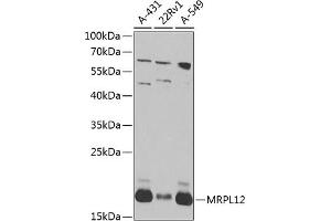 Western blot analysis of extracts of various cell lines, using MRPL12 antibody (ABIN6128293, ABIN6144004, ABIN6144005 and ABIN6224337) at 1:1000 dilution. (MRPL12 antibody  (AA 1-198))