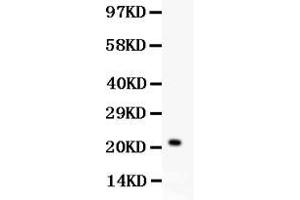 Western blot analysis of IL-18 expression in HELA whole cell lysates ( Lane 1). (IL-18 antibody  (C-Term))