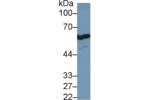 Detection of FOXP3 in Human Jurkat cell lysate using Polyclonal Antibody to Forkhead Box P3 (FOXP3) (FOXP3 antibody  (AA 190-412))