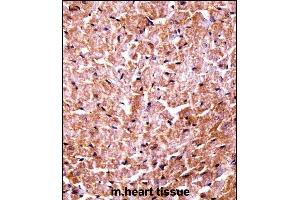 Mouse Camk2d Antibody (Center) ((ABIN657721 and ABIN2846708))immunohistochemistry analysis in formalin fixed and paraffin embedded mouse heart tissue followed by peroxidase conjugation of the secondary antibody and DAB staining.