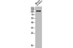 Western blot analysis of mouse-kidney lysis using CD203c antibody. (ENPP3 antibody  (Internal Region))