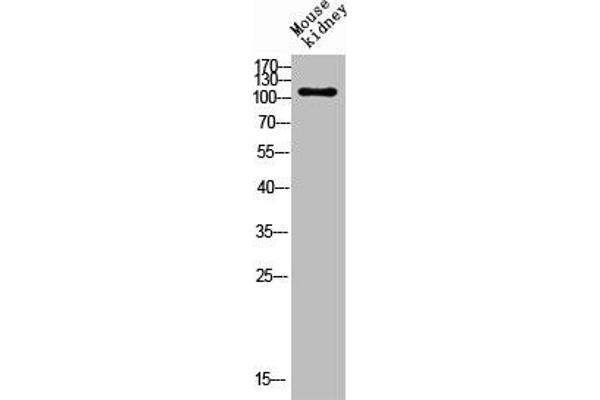 ENPP3 antibody  (Internal Region)