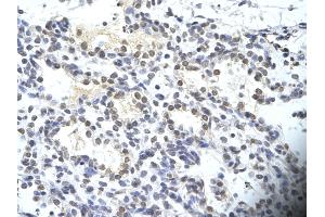 Rabbit Anti-SIRT3 Antibody       Paraffin Embedded Tissue:  Human alveolar cell   Cellular Data:  Epithelial cells of renal tubule  Antibody Concentration:   4. (SIRT3 antibody  (C-Term))