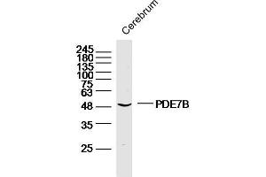 Mouse cerebrum lysates probed with PDE7B Polyclonal Antibody, unconjugated  at 1:300 overnight at 4°C followed by a conjugated secondary antibody at 1:10000 for 90 minutes at 37°C. (PDE7B antibody  (AA 281-360))