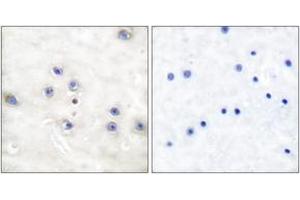 Immunohistochemistry analysis of paraffin-embedded human brain tissue, using COT (Ab-290) Antibody. (CROT antibody  (AA 256-305))