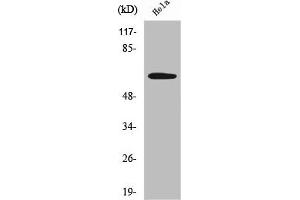 Western Blot analysis of HeLa cells using Sgo1 Polyclonal Antibody (Shugoshin antibody  (Internal Region))