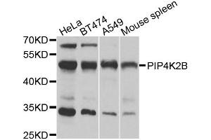 Western blot analysis of extracts of various cell lines, using PIP4K2B antibody. (PIP4K2B antibody)
