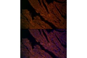 Immunofluorescence analysis of mouse heart cells using RYR2 Rabbit pAb (ABIN1513493, ABIN3020906, ABIN3020907 and ABIN6213787) at dilution of 1:200 (40x lens). (RYR2 antibody  (AA 4850-4950))