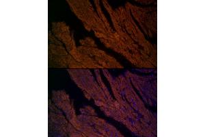Immunofluorescence analysis of mouse heart cells using RYR2 Rabbit pAb (ABIN1513493, ABIN3020906, ABIN3020907 and ABIN6213787) at dilution of 1:200 (40x lens). (RYR2 antibody  (AA 4850-4950))