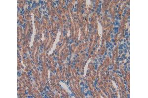 Used in DAB staining on fromalin fixed paraffin- embedded kidney tissue (RBP2 antibody  (AA 1-134))