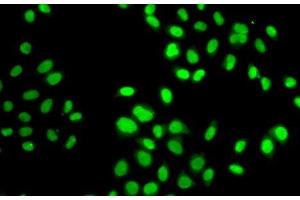 Immunofluorescence analysis of MCF7 cells using GPS1 Polyclonal Antibody (GPS1 antibody)