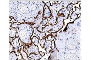 IHC analysis of Steroid Sulfatase/STS using anti-Steroid Sulfatase/STS antibody (ABIN7601166). (STS antibody  (AA 297-547))