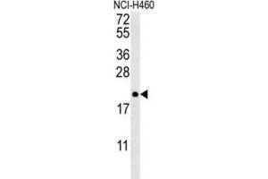 Western Blotting (WB) image for anti-Protein tyrosine Phosphatase Type IVA, Member 2 (PTP4A2) antibody (ABIN3002826) (PTP4A2 antibody)