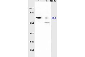 SDS-PAGE (SDS) image for anti-Hepatitis C Virus RNA-Directed RNA Polymerase (HCV RdRP) (AA 2501-2600) antibody (ABIN1385126)