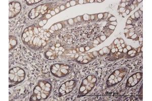 Immunoperoxidase of purified MaxPab antibody to PAGE1 on formalin-fixed paraffin-embedded human small Intestine. (PAGE1 antibody  (AA 1-146))